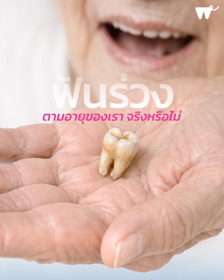 ฟันแท้อยู่ได้นานแค่ไหน? อายุเยอะแล้วฟันต้องหลุดจริงหรือไม่